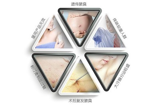 去哪个医院治疗腋臭比较好